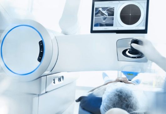 Paziente posizionato sotto il laser a femtosecondi durante la cheratopigmentazione